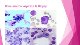 Bone Marrow Aspirate & Biopsy