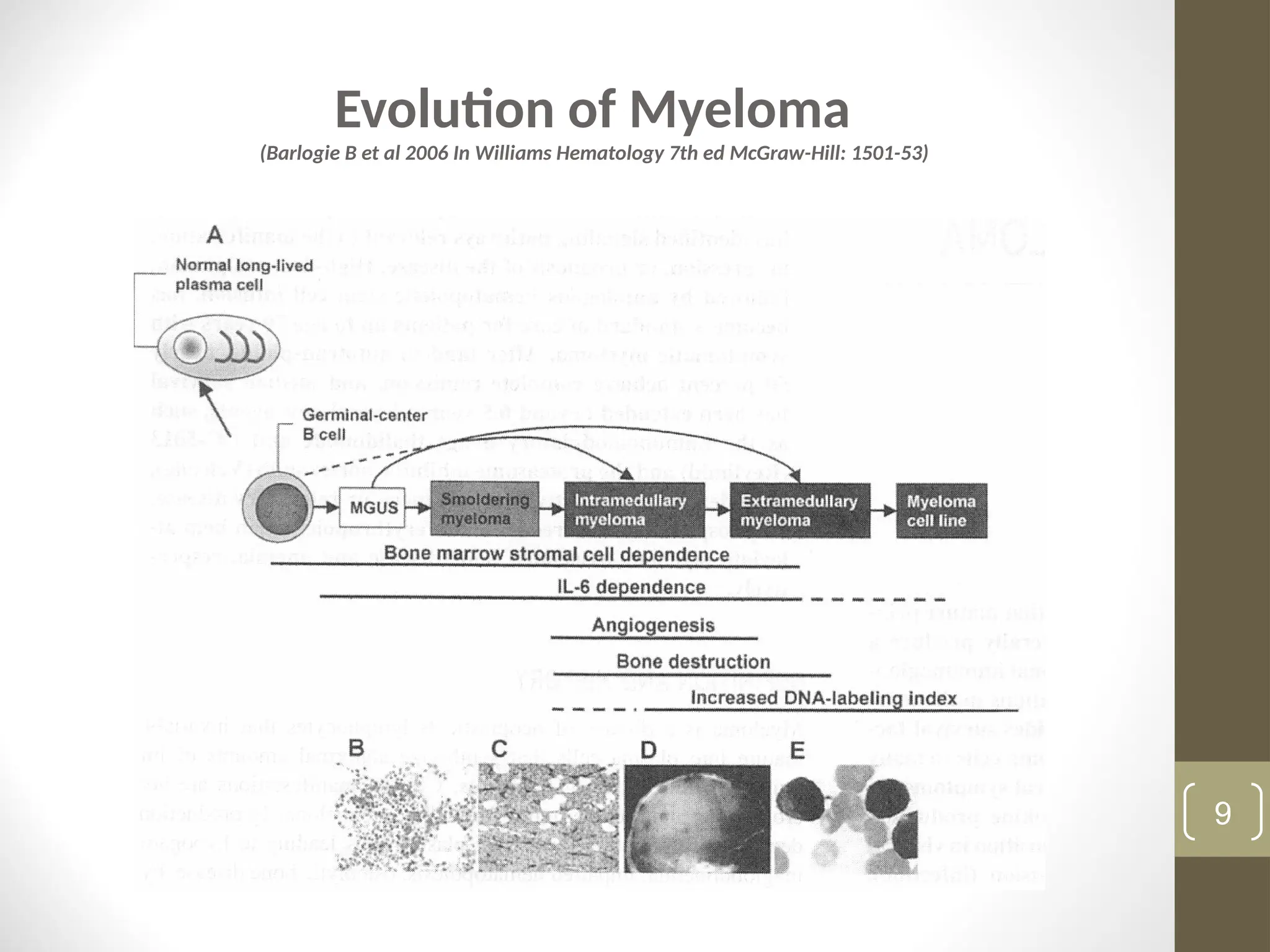 Evolution of Myeloma
(Barlogie B et al 2006 In Williams Hematology 7th ed McGraw-Hill: 1501-53)
9
 