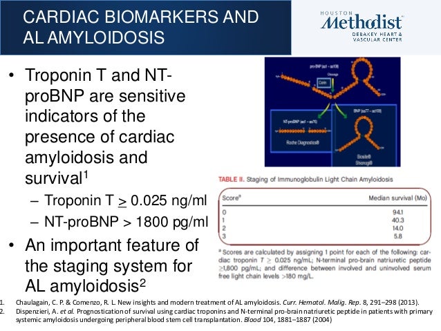 Multiple myeloma and al amyloidosis