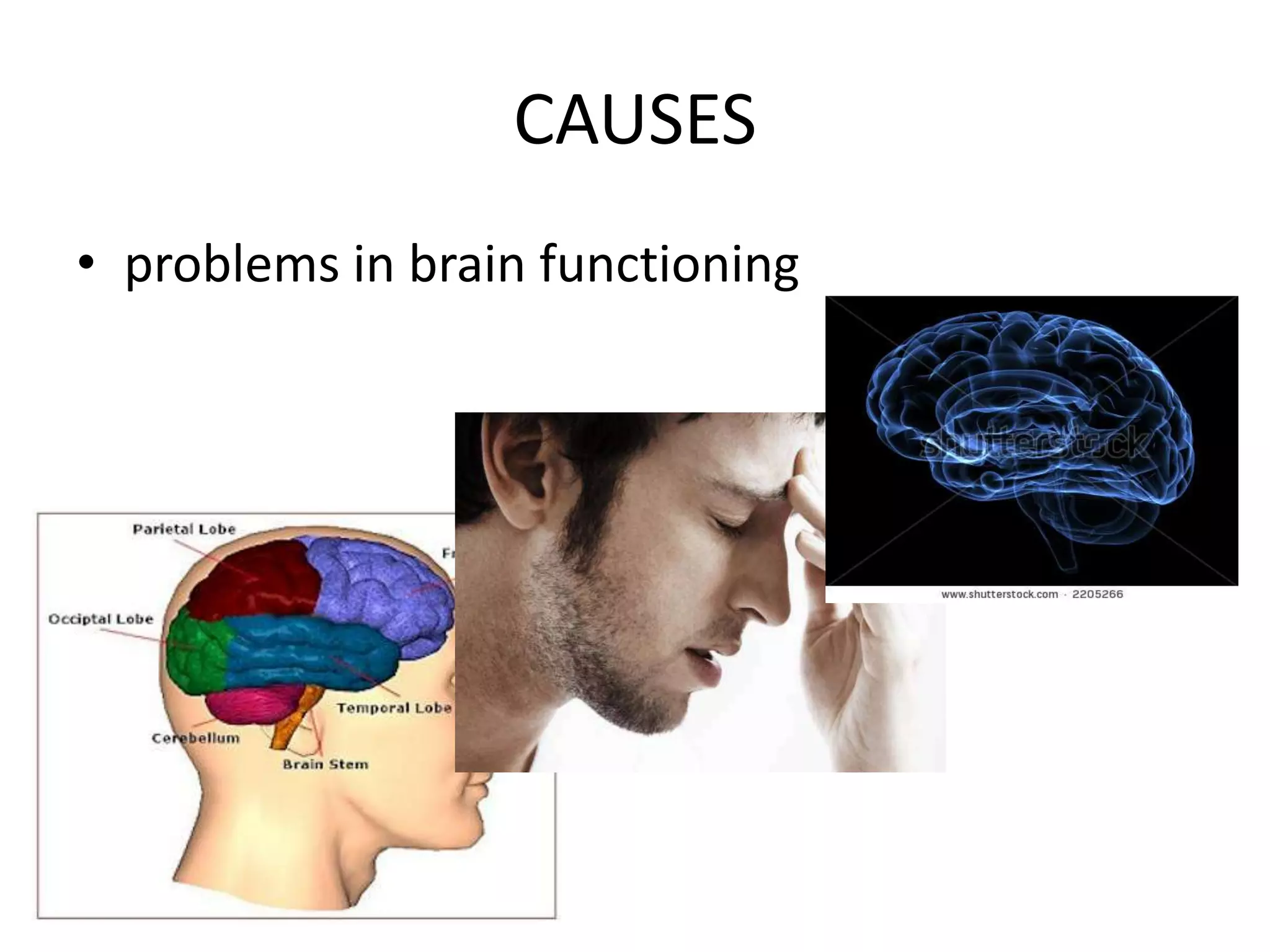 Multiple personality disorder | PPTX