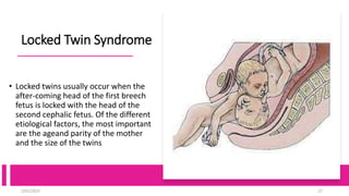 Locked Twin Syndrome
• Locked twins usually occur when the
after-coming head of the first breech
fetus is locked with the head of the
second cephalic fetus. Of the different
etiological factors, the most important
are the ageand parity of the mother
and the size of the twins
2/01/2023 27
 
