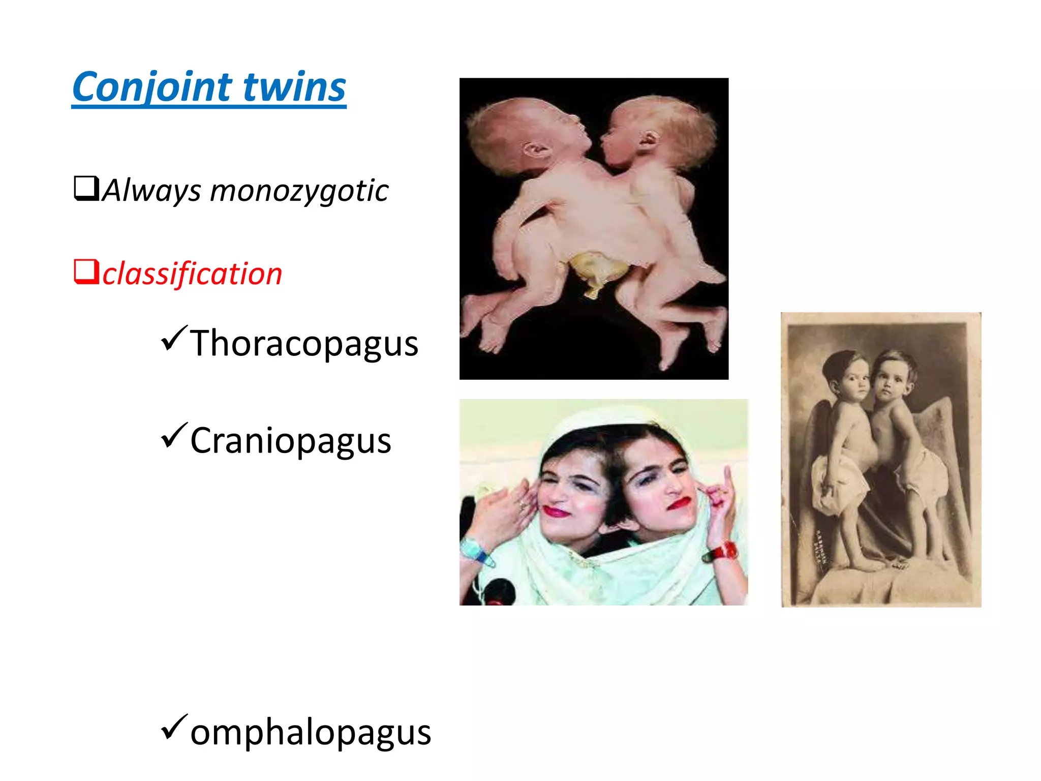 Conjoint twins

Always monozygotic

classification

      Thoracopagus

      Craniopagus




      omphalopagus
 