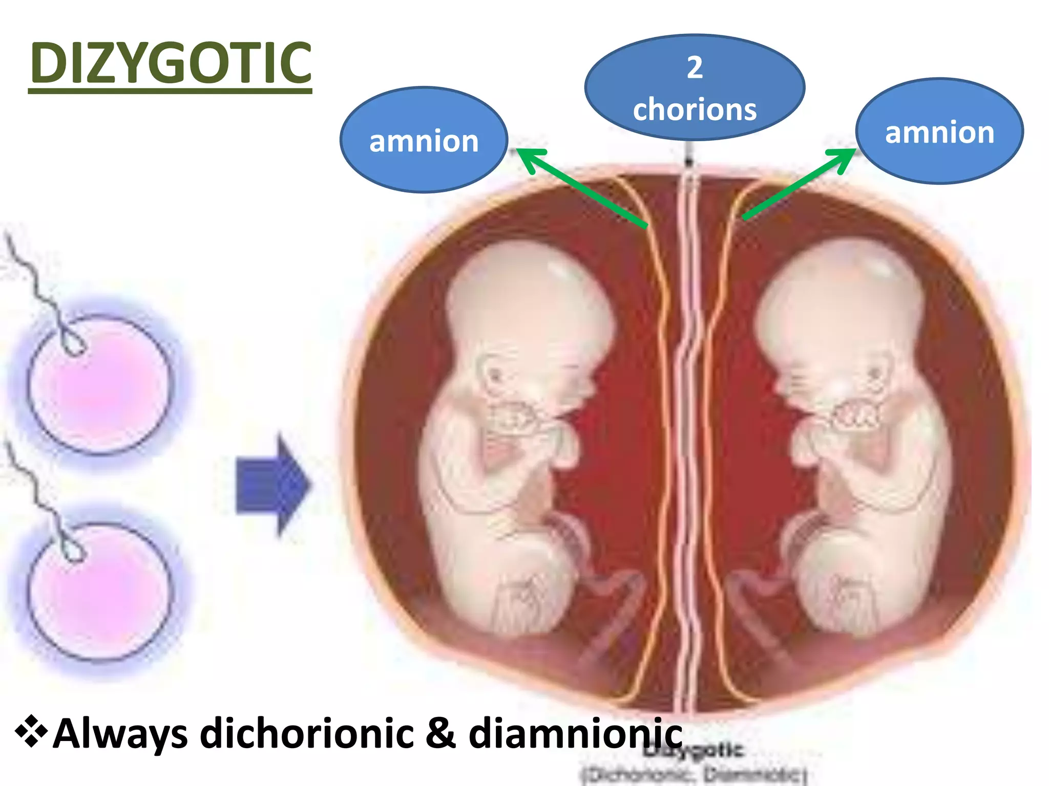 DIZYGOTIC                       2
                             chorions
                 amnion                 amnion




Always dichorionic & diamnionic
 