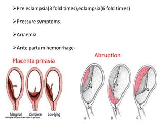 Pre eclampsia(3 fold times),eclampsia(6 fold times)

Pressure symptoms

Anaemia

Ante partum hemorrhage-
                                    Abruption
Placenta preavia
 