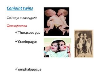 Conjoint twins

Always monozygotic

classification

      Thoracopagus

      Craniopagus




      omphalopagus
 