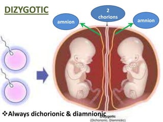 DIZYGOTIC                       2
                             chorions
                 amnion                 amnion




Always dichorionic & diamnionic
 