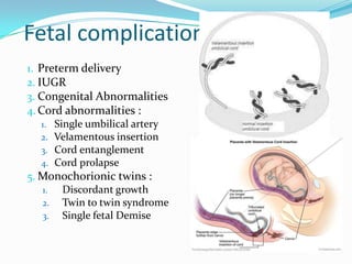 Fetal complications
1. Preterm delivery
2. IUGR
3. Congenital Abnormalities
4. Cord abnormalities :
1. Single umbilical artery
2. Velamentous insertion
3. Cord entanglement
4. Cord prolapse
5. Monochorionic twins :
1.
Discordant growth
2. Twin to twin syndrome
3. Single fetal Demise

 