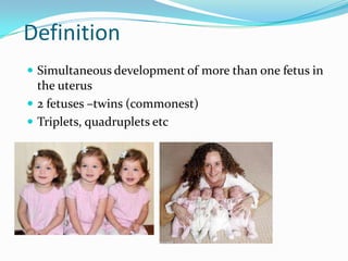 Definition
 Simultaneous development of more than one fetus in

the uterus
 2 fetuses –twins (commonest)
 Triplets, quadruplets etc

 