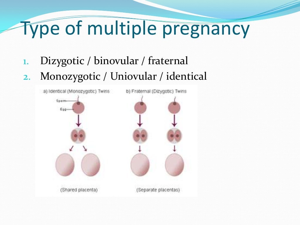 Multiple Pregnancy