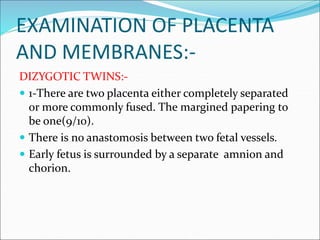 Multiple pregnancy by tanoj patidar