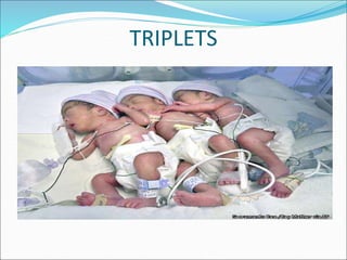 Multiple pregnancy by tanoj patidar