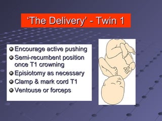 Multiple pregnancy file | PPT