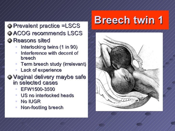 Multiple pregnancy file