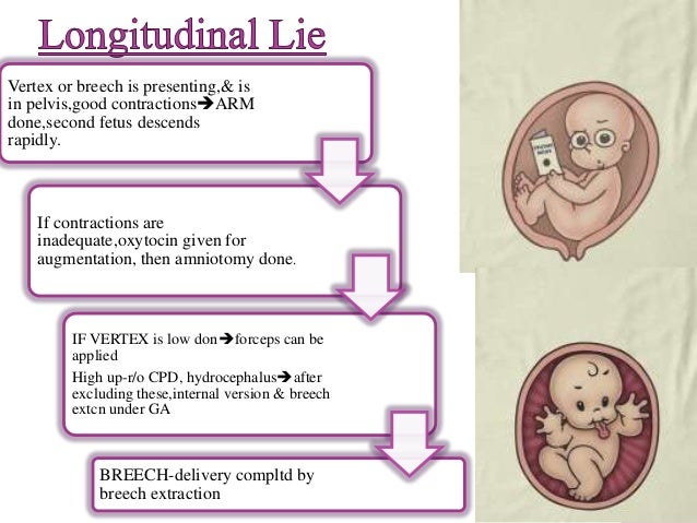 Multiple Pregnancy Management