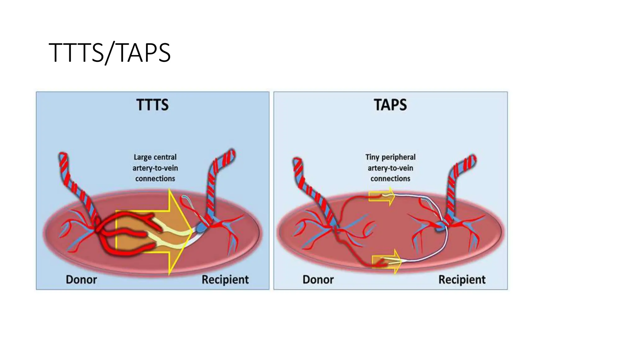 Ttspps Guidelines.pdf MULTIPLE PREGNANCY revision 2.pptx