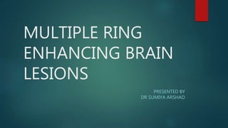 MULTIPLE RING
ENHANCING BRAIN
LESIONS
PRESENTED BY
DR SUMIYA ARSHAD
 