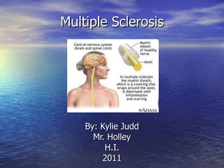 Multiple Sclerosis By: Kylie Judd Mr. Holley H.I. 2011 