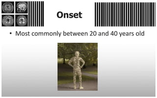 Onset

• Most commonly between 20 and 40 years old
 
