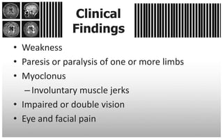 Clinical
              Findings
• Weakness
• Paresis or paralysis of one or more limbs
• Myoclonus
   – Involuntary muscle jerks
• Impaired or double vision
• Eye and facial pain
 