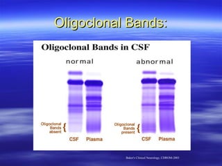Oligoclonal Bands:




           Baker's Clinical Neurology, CDROM-2003
 