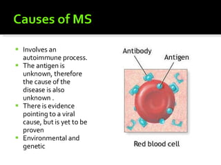 Involves an autoimmune process. The antigen is unknown, therefore the cause of the disease is also unknown . There is evidence pointing to a viral cause, but is yet to be proven Environmental and genetic 