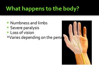 Numbness and limbs Severe paralysis Loss of vision *Varies depending on the person 