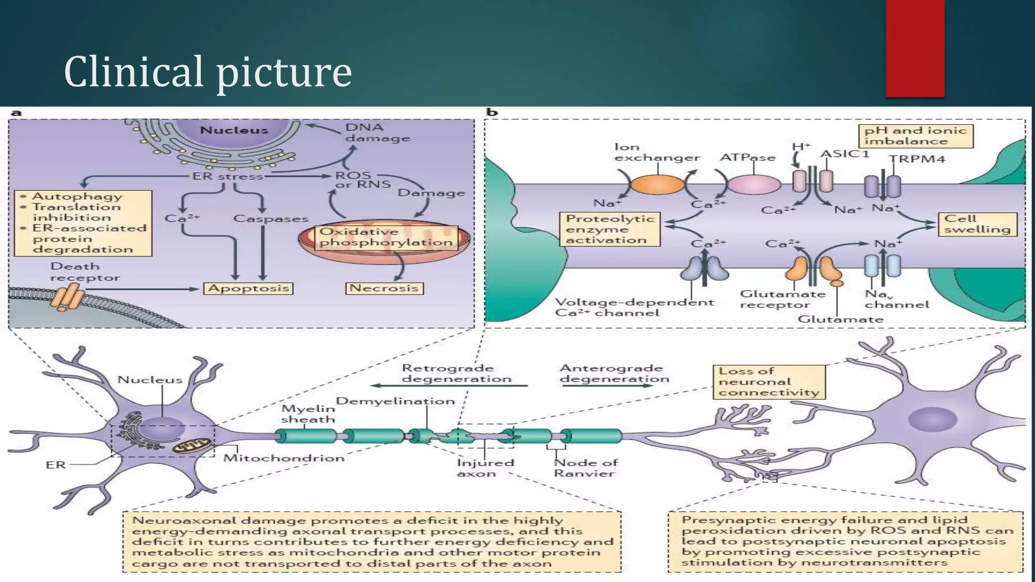 Clinical picture
 