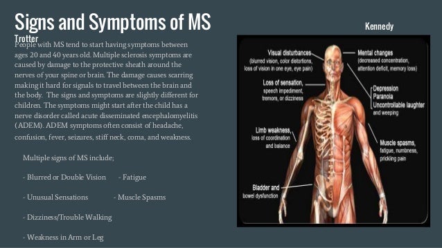 Multiple sclerosis Multiple sclerosis