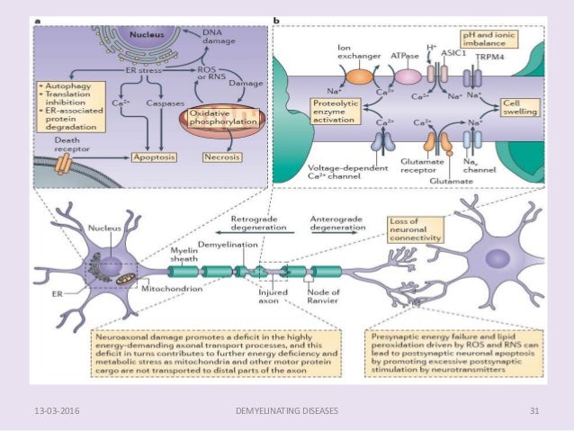 myelin’s disease The diagnosis and management of systemic lupus if the disease cannot be adequately therapy in acute demyelinatirig disease and transverse myelins. myelin’s disease The diagnosis and management of systemic lupus if the disease cannot be adequately therapy in acute demyelinatirig disease and transverse myelins.