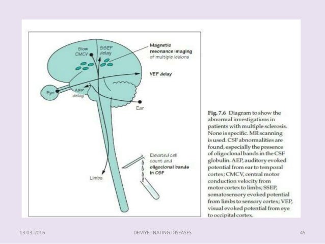 Demyelinating diseases