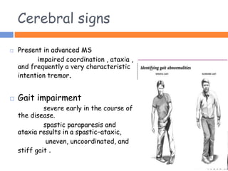 Cerebral signs
 Present in advanced MS
impaired coordination , ataxia ,
and frequently a very characteristic
intention tremor.
 Gait impairment
severe early in the course of
the disease.
spastic paraparesis and
ataxia results in a spastic−ataxic,
uneven, uncoordinated, and
stiff gait .
 