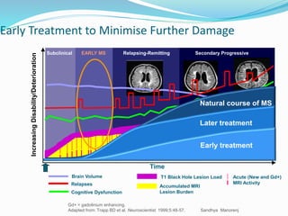 Early Treatment to Minimise Further Damage
Gd+ = gadolinium enhancing.
Adapted from: Trapp BD et al. Neuroscientist. 1999;5:48-57. Sandhya Manorenj
Relapses
Brain Volume T1 Black Hole Lesion Load
Cognitive Dysfunction
Accumulated MRI
Lesion Burden
Acute (New and Gd+)
MRI Activity
Time
IncreasingDisability/Deterioration
Subclinical EARLY MS Relapsing-Remitting Secondary Progressive
Natural course of MS
Later treatment
Early treatment
 