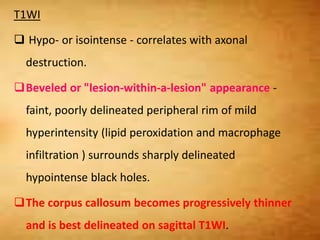 T1WI
 Hypo- or isointense - correlates with axonal
destruction.
Beveled or "lesion-within-a-lesion" appearance -
faint, poorly delineated peripheral rim of mild
hyperintensity (lipid peroxidation and macrophage
infiltration ) surrounds sharply delineated
hypointense black holes.
The corpus callosum becomes progressively thinner
and is best delineated on sagittal T1WI.
 