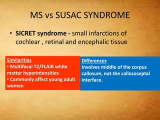 MS vs SUSAC SYNDROME
• SICRET syndrome - small infarctions of
cochlear , retinal and encephalic tissue
Similarities
• Multifocal T2/FLAIR white
matter hyperintensities
• Commonly affect young adult
women
Differences
Involves middle of the corpus
callosum, not the callososeptal
interface.
 
