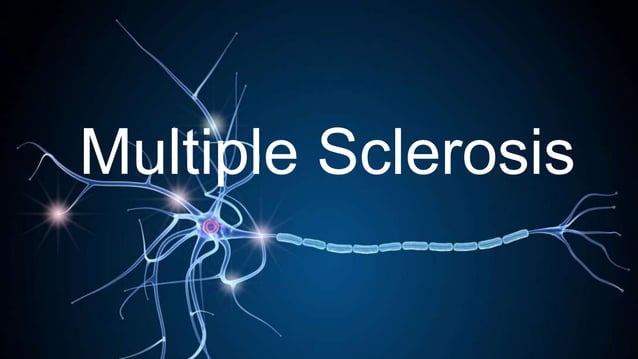 Multiple sclerosis: Introduction, Risk Factors, Diagnosis and Treatment ...
