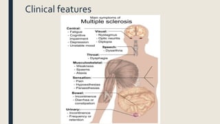 Clinical features
 