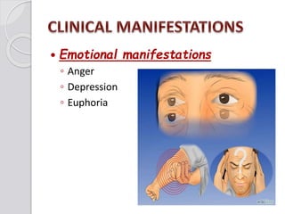  Emotional manifestations
◦ Anger
◦ Depression
◦ Euphoria
 