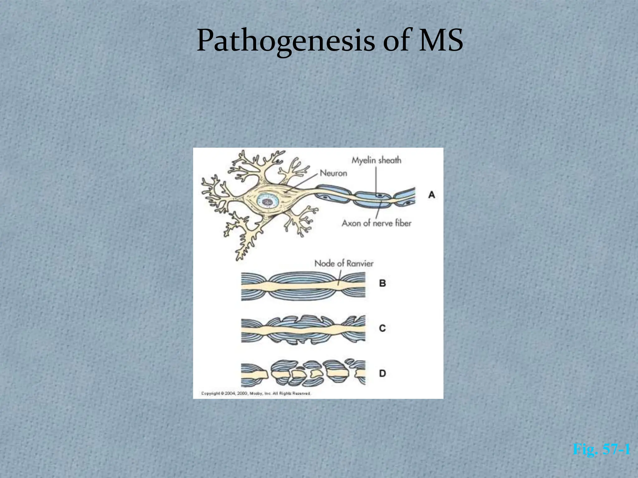 Pathogenesis of MS
Fig. 57-1
 