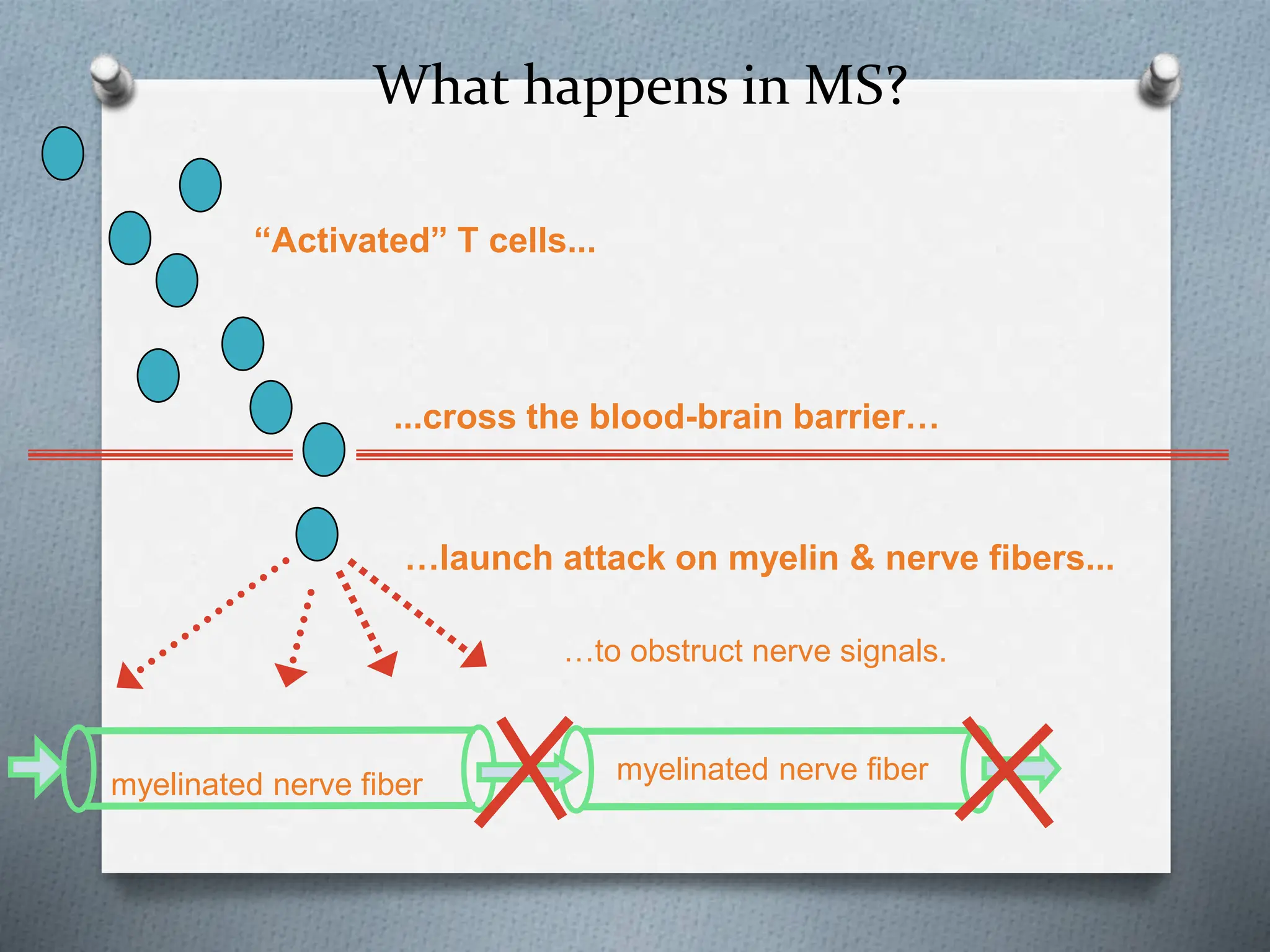 What happens in MS?
...cross the blood-brain barrier…
…launch attack on myelin & nerve fibers...
“Activated” T cells...
…to obstruct nerve signals.
myelinated nerve fiber myelinated nerve fiber
 