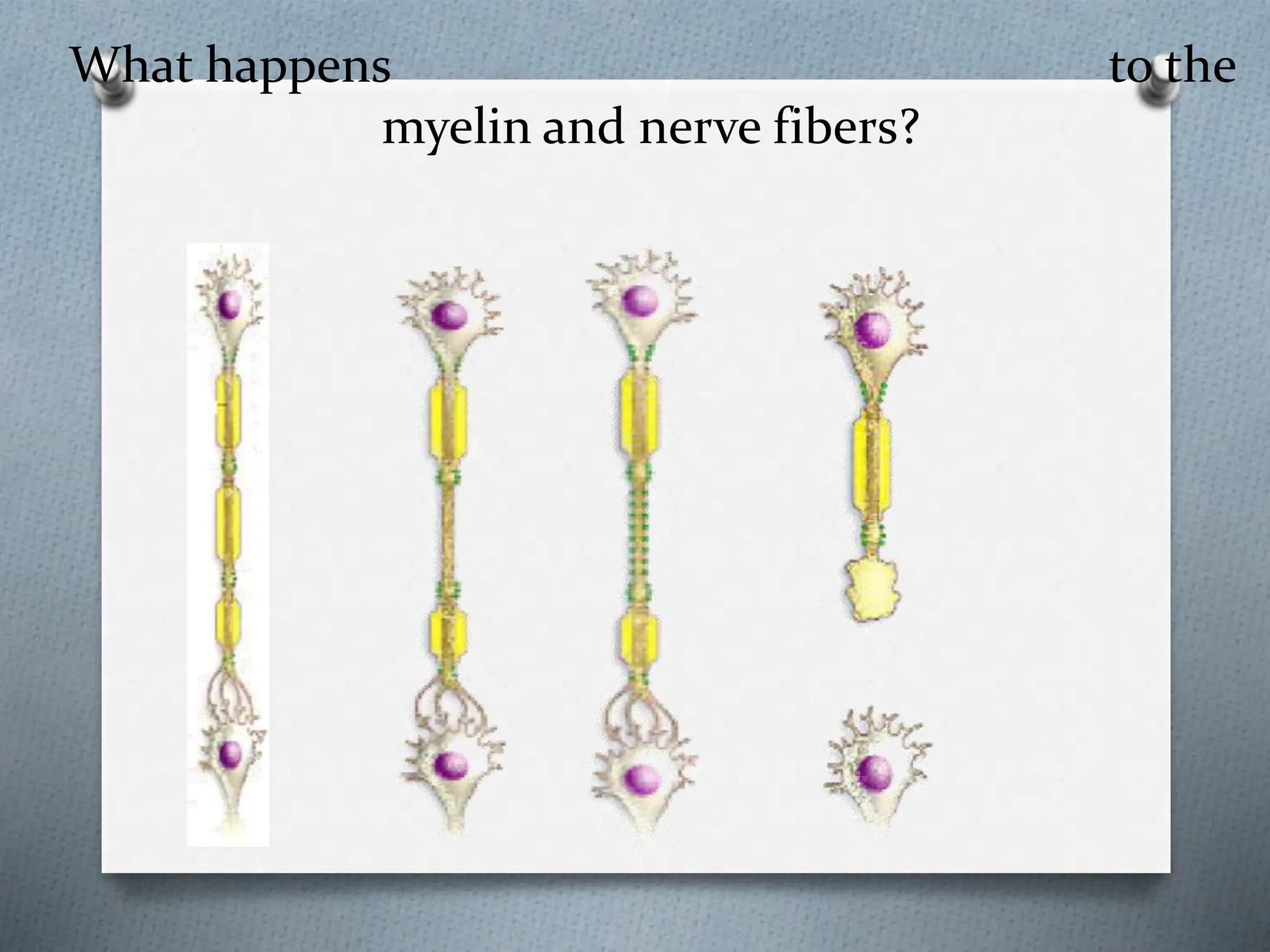 What happens to the
myelin and nerve fibers?
 