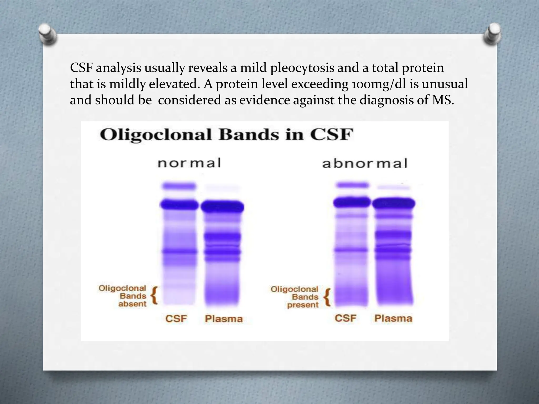 CSF analysis usually reveals a mild pleocytosis and a total protein
that is mildly elevated. A protein level exceeding 100mg/dl is unusual
and should be considered as evidence against the diagnosis of MS.
 