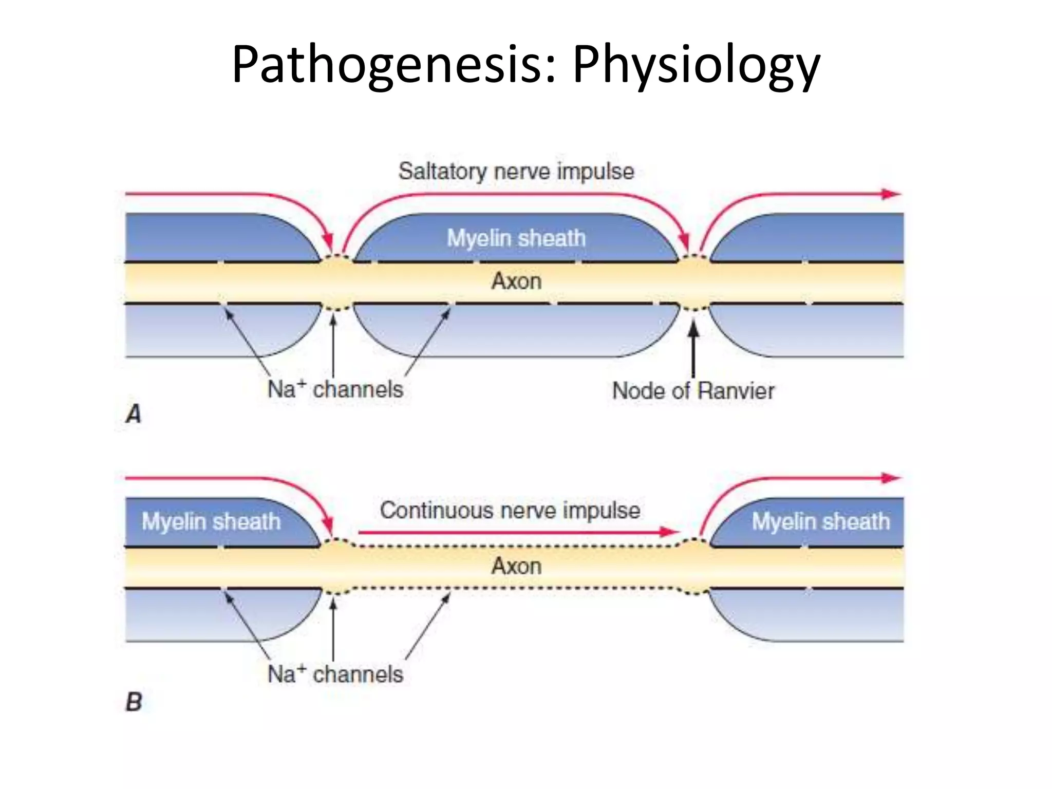 Pathogenesis: Physiology
 