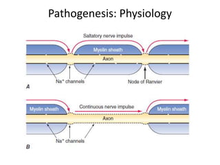 Pathogenesis: Physiology
 