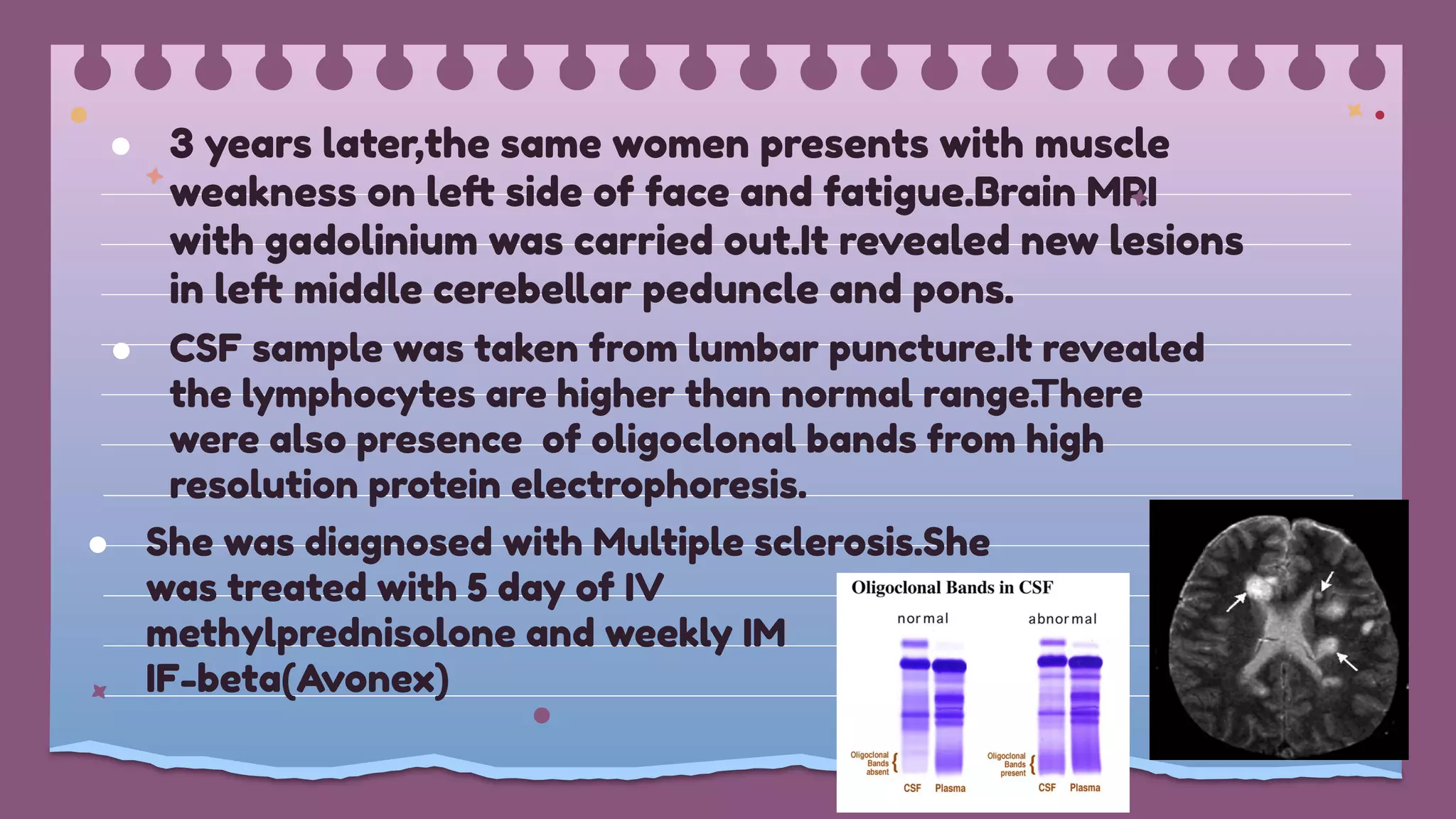 ● 3 years later,the same women presents with muscle
weakness on left side of face and fatigue.Brain MRI
with gadolinium was carried out.It revealed new lesions
in left middle cerebellar peduncle and pons.
● CSF sample was taken from lumbar puncture.It revealed
the lymphocytes are higher than normal range.
There
were also presence of oligoclonal bands from high
resolution protein electrophoresis.
● She was diagnosed with Multiple sclerosis.She
was treated with 5 day of IV
methylprednisolone and weekly IM
IF-beta(Avonex)
 
