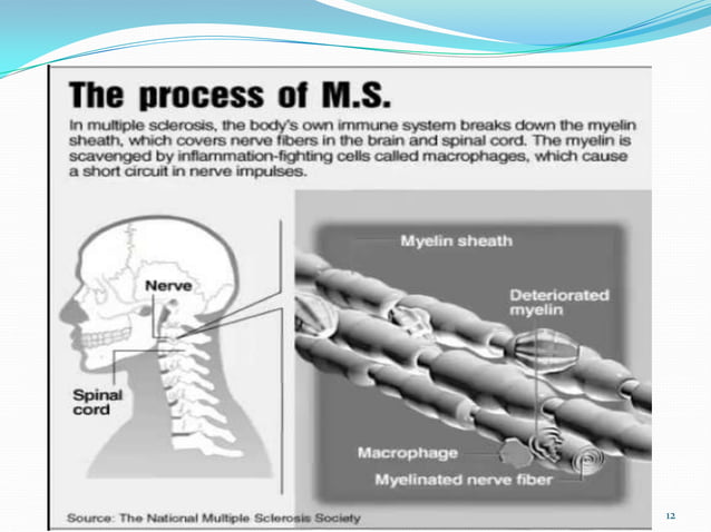 Multiple sclerosis adjusted to publish | PPT