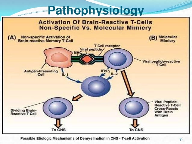 Multiple sclerosis adjusted to publish