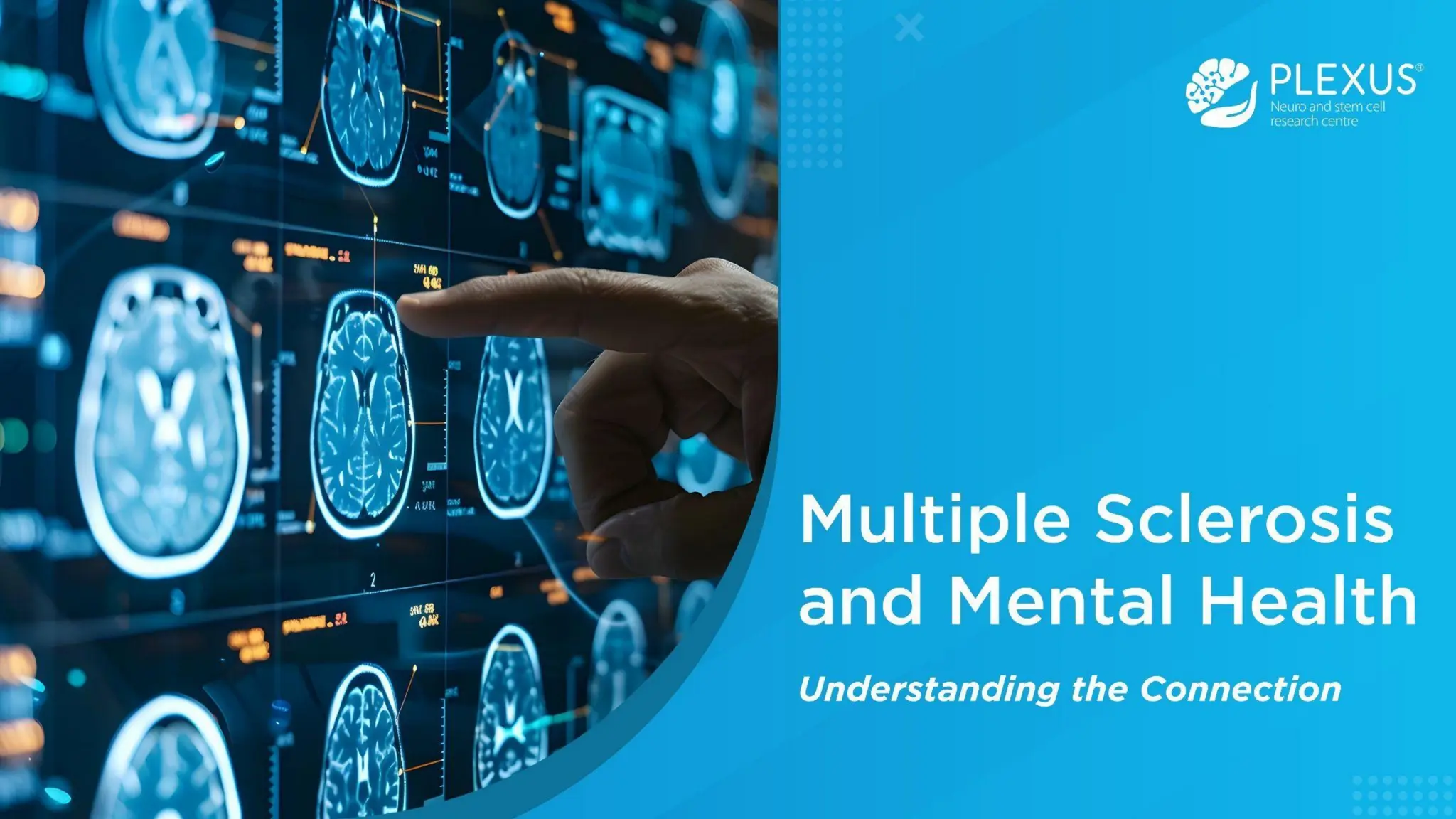 Multiple Sclerosis and Mental Health.pptx