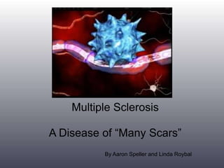 Multiple Sclerosis

A Disease of “Many Scars”
          By Aaron Speller and Linda Roybal
 