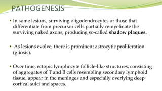 PATHOGENESIS
 In some lesions, surviving oligodendrocytes or those that
differentiate from precursor cells partially remyelinate the
surviving naked axons, producing so-called shadow plaques.
 As lesions evolve, there is prominent astrocytic proliferation
(gliosis).
 Over time, ectopic lymphocyte follicle-like structures, consisting
of aggregates of T and B cells resembling secondary lymphoid
tissue, appear in the meninges and especially overlying deep
cortical sulci and spaces.
 