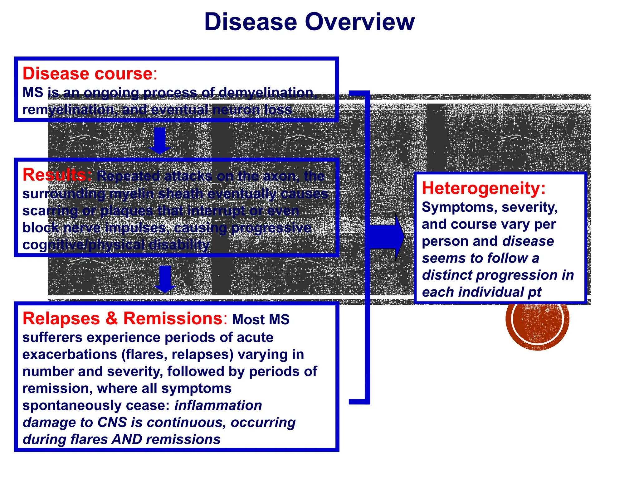 Disease Overview
Disease course:
MS is an ongoing process of demyelination,
remyelination, and eventual neuron loss
Relapses & Remissions: Most MS
sufferers experience periods of acute
exacerbations (flares, relapses) varying in
number and severity, followed by periods of
remission, where all symptoms
spontaneously cease: inflammation
damage to CNS is continuous, occurring
during flares AND remissions
Results: Repeated attacks on the axon, the
surrounding myelin sheath eventually causes
scarring or plaques that interrupt or even
block nerve impulses, causing progressive
cognitive/physical disability
Heterogeneity:
Symptoms, severity,
and course vary per
person and disease
seems to follow a
distinct progression in
each individual pt
 